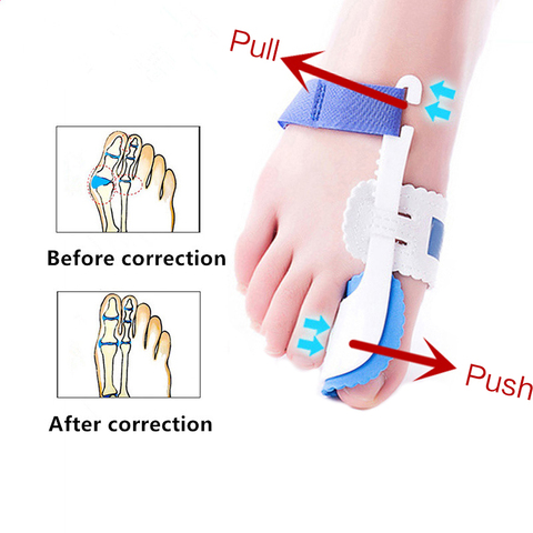 2Pcs Hallux Valgus Corrector For Feet Toe Separator Fingers Feet Haluksy Separator For Toe Orthopedic Foot Care Bunion Corrector ► Photo 1/6