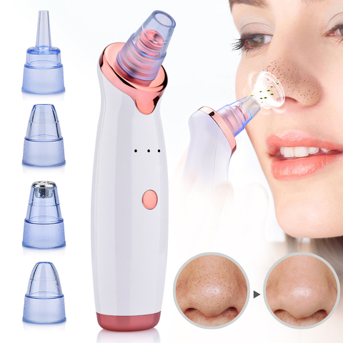 Pore Cleaner Nose Blackhead Remover Face Deep T Zone Acne Pimple Removal Part Tools ► Photo 1/6