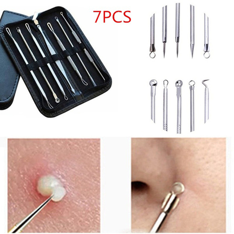 Stainless Steel Blackhead Remover Tool Kit Extractor Pimple Blemish Spot Needles Acne Remover Face Skin Care Beauty Tool 1 set ► Photo 1/6