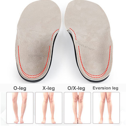 Children Kids Orthopendic Insoles Arch Support for Flat Feet Shoe Pads Insert O/X Type Leg Varus Orthotic Cushion Foot Corrector ► Photo 1/6