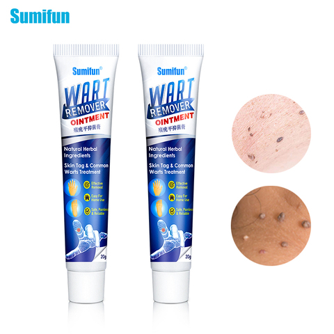 Sumifun Warts Remover Antibacterial Ointment Wart Treatment Cream Skin Tag Remover Herbal Extract Corn Plaster Warts Ointment ► Photo 1/6