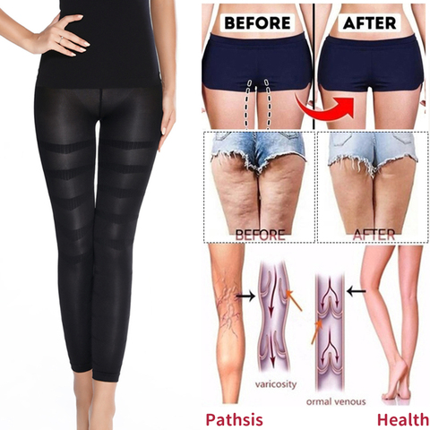 Shapewear Anti Cellulite Compression Leggings Leg Slimming Body Shaper High Waist Tummy Control Panties Thigh Sculpting Slimmer ► Photo 1/6
