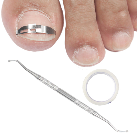 Ingrown Toe Nail Correction Tool Toenail Straightening Correctors Patch Tool Kit Nail Repairer Orthosis Beauty Tools ► Photo 1/6
