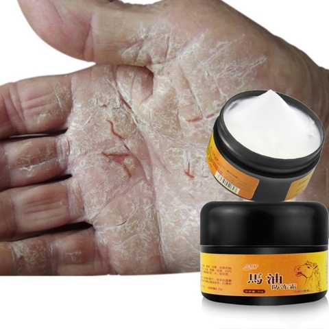 30g Horse Oil Foot Cream Chapped Skin Repairing Moisturizer Dry Rough Cracked Feet Heel Skin Care ► Photo 1/6