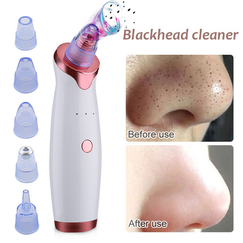 Electric Acne Remover Point Noir Blackhead Vacuum Extractor Tool Black Spots Pore Cleaner Skin Care Facial Pore Cleaner Machine ► Photo 1/6