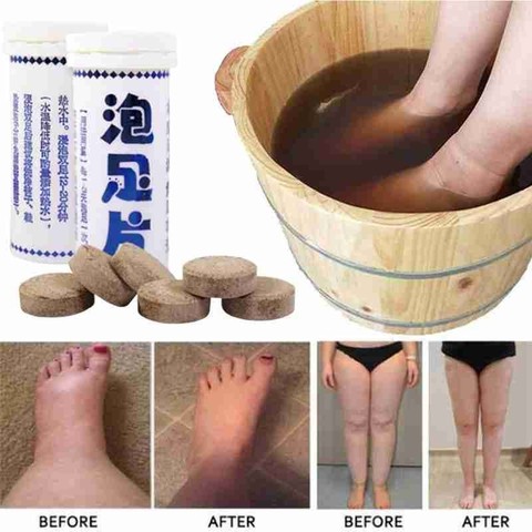 6 Pcs/Bottle Foot Wash Effervescent Tablet Fungal Nail Treatment Detox Foot Soak Long-Term Relief Athlete's Foot Skin Cracking ► Photo 1/6