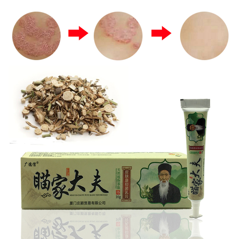 Psoriasis Antibacterial Cream Sulfur Soap Handmade Chinese Herbal Restrain Bacterium Sulphur Soap Whitening Bath ► Photo 1/6