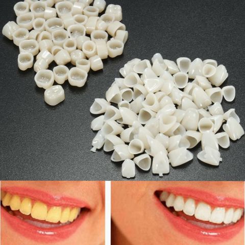 120pcs Dental Material Teeth Mixed Temporary Crown 70pcs Anteriors Front Tooth 50pcs Molar Posterior Veneers Teeth Care Tool ► Photo 1/6