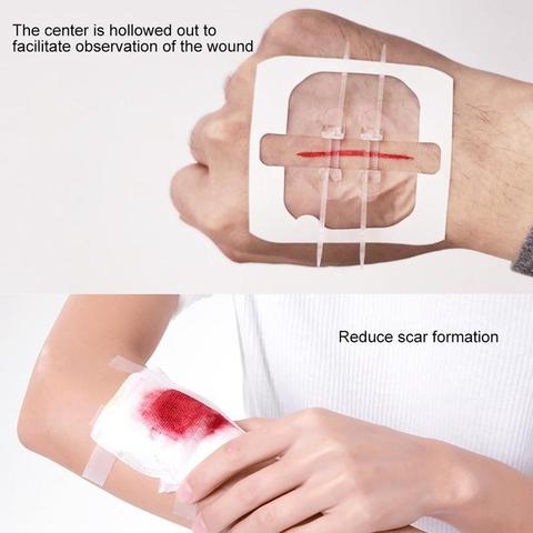 1pc Zipper Tie Wound Closure Patch Hemostatic Patch Wound Fast Suture Zipper Band-Aid Outdoor Portable ► Photo 1/6