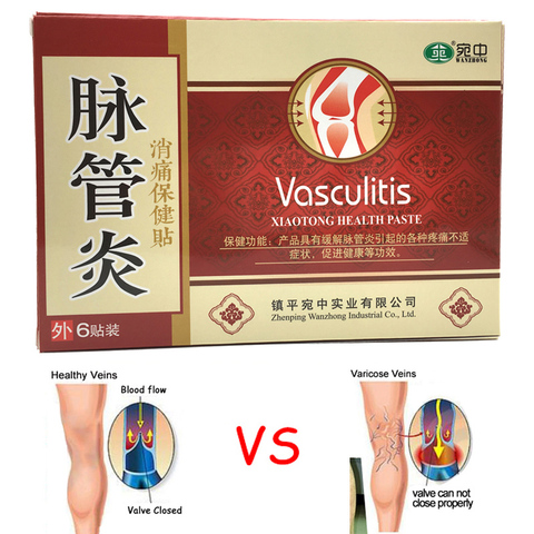 21 Pcs Spider Veins Varicose Treatment Plaster Varicose Veins Cure Patch Vasculitis Natural Solution Herbal Patches ► Photo 1/6