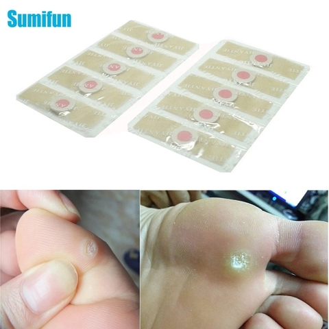 12pcs Sumifun Foot Corn Killer Calluses Plantar Warts Thorn Pain Relief Plaster Medical Sticker  Foot Pad Curative Plasters ► Photo 1/6