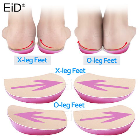 XO Legs Orthopedic shoes Insoles Silicone Gel Arch Support Pad for Women Flat Foot Orthotic Inserts Pain Relief High Heel Pads ► Photo 1/6