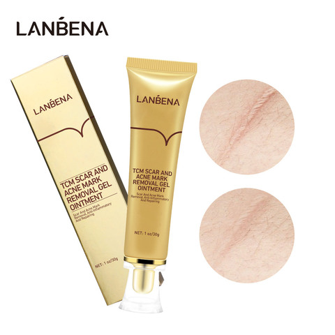 LANBENA Acne Scar Removal Cream Cosmetics For Face Screm TCM Herbal Repair Stretch Marks Remove Scar Treatment Bioaqua Skin Care ► Photo 1/1