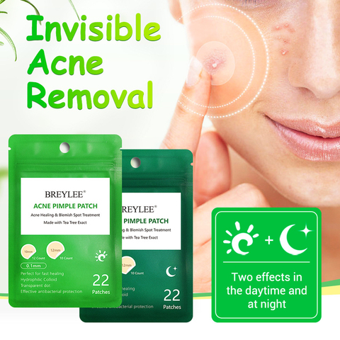 BREYLEE Acne Remover Patch Anti Acne Blackhead Pimple Blemish Treatment Sticker Mask Facial Skin Care Tools ► Photo 1/6