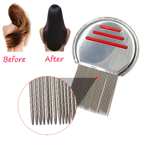 1PC Stainless Steel Kids Hair Terminator Lice Comb Nit Free Rid Headlice Super Density Teeth Remove Nits Comb Hair Tool Dropship ► Photo 1/6