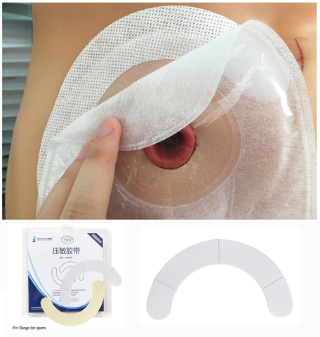 40 PCS Ostomy Care Hydrocolloid Tape , Portable fixed tape for Colostomy Bags, Prevent flange warping and shifting for sport ► Photo 1/6