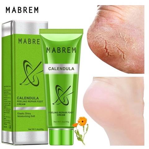 MABREM Foot Treatment Cream Whitening Anti-cracking Moisturizing Foot Care Exfoliating Scrub Anti-dry Calendula Olive Repair 40g ► Photo 1/6