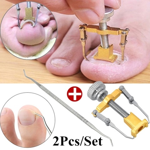 ingrown toenails correction pedicure foot toe nail care tools file Elastic Patch Straightening Clip Brace corrector Wire Fixer ► Photo 1/6