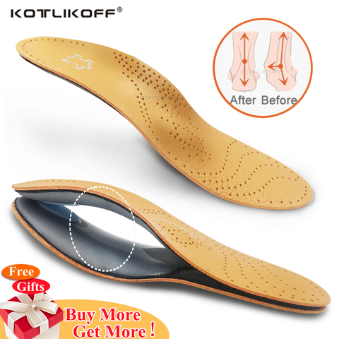 Leather orthotic insole for Flat Feet Arch Support orthopedic shoes sole Insoles for feet men women Children O/X Leg corrected ► Photo 1/6