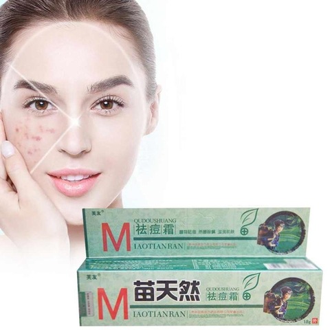 1pcs Remove Acne Cream Germicidal Remove Mite And Moisturize Your Skin ointment ► Photo 1/5