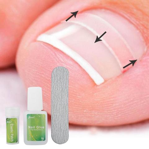 12pcs /bottle Ingrown Toenail Correction Tool Set Ingrown Toe Nail Pedicure Elastic Patch Straightening Clip Brace with Glue ► Photo 1/6