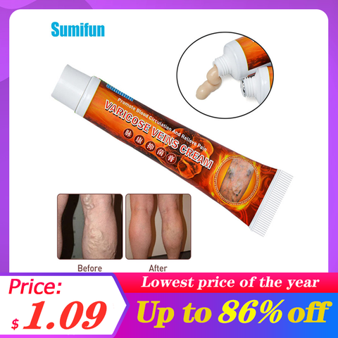Sumifun 1Pcs 20g Varicose Veins Treatment Cream Angiitis Remedy Ointment Relief Veins Pain Phlebitis legs Varicose Veins Cream ► Photo 1/6