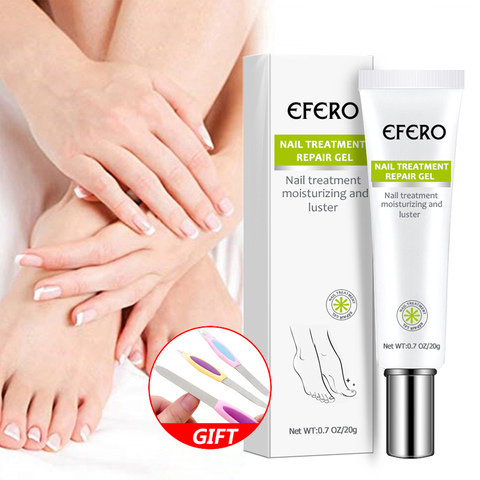 Fungal Nail Treatment Serum Nail Foot Nail Fungus Removal Gel Anti Infection Onychomycosis Nail Repair Essence Cream Feet Care ► Photo 1/6