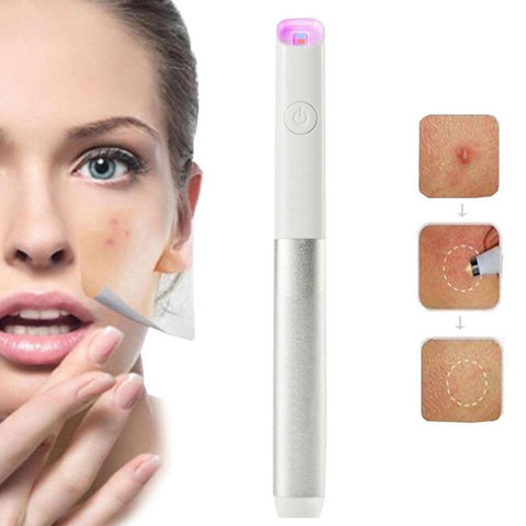 Blue Light Red Therapy Acne Spot Treatment Laser Pen Blackhead Blemish Remover Scar Wrinkle Removal Device ► Photo 1/6