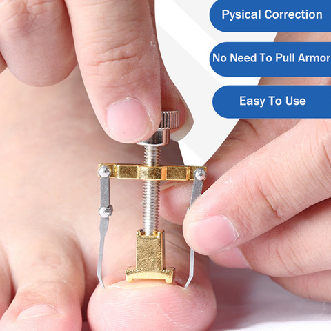 Top 10 Best Ingrown Toenail Correction Tool Must Have 3