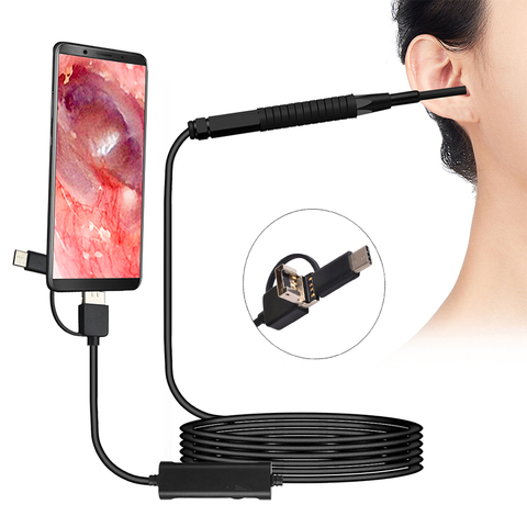 3.9MM lens ear otoscope HD720P three-in-one interface digital video otoscope mini ear tunnel camera micro usb android endoscope ► Photo 1/6