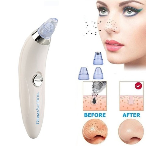 Blackhead Remover Vaccum Suction Facial Cleaner Pore Spot Blackhead Acne Removal Skin Care Tool Facial Beauty Black Head Remove ► Photo 1/6