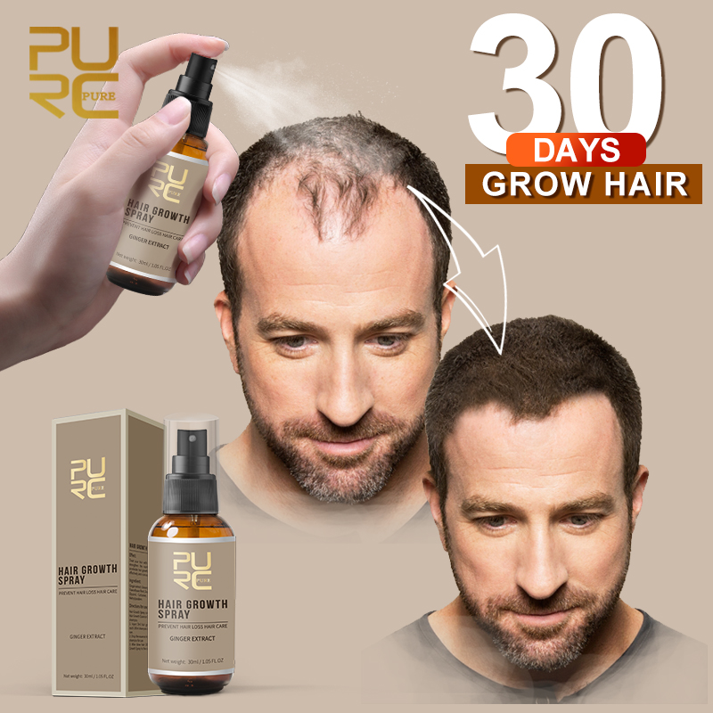 Buy Online Purc New Hair Growth Spray Fast Grow Hair Hair Loss Treatment For Thinning Hair Hair Care 30ml Alitools