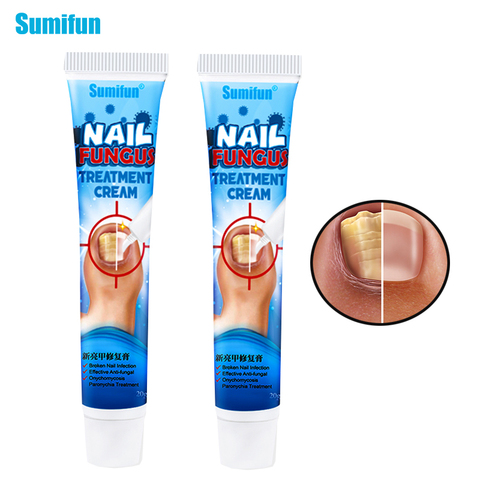 1pcs Nail Fungus Treatment Cream Onychomycosis Paronychia Herbal Antibacterial Repair Ointment Anti Fungal Feet Toe Care P1148 ► Photo 1/6