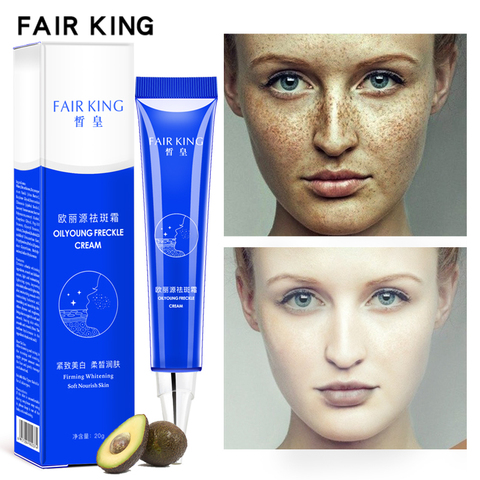 Dark Spot Corrector Skin Whitening Fade Cream Lightening Blemish Removal Serum Reduces Age Spots Freckles Face Cream 20g ► Photo 1/6