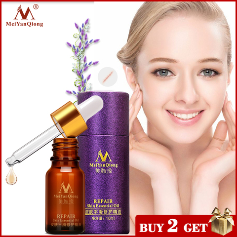 Scar Repair Skin Essential Oil Lavender Essence Skin Care Natural Pure Remove Ance Burn Strentch Marks Scar Removal Treatment ► Photo 1/6