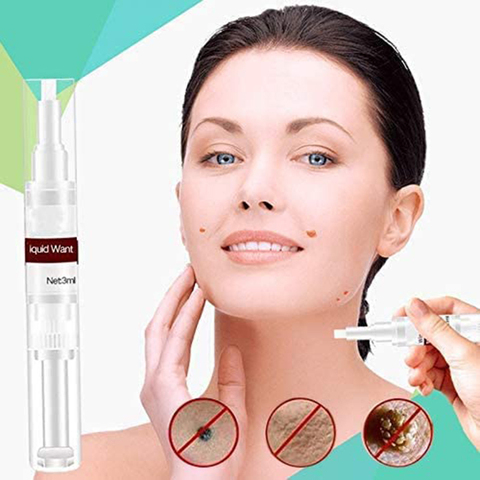 Skin Tag Mole Wart Remover Liquid WipeOff Tags & Moles Removal Pen Organic Tags Solutions Wart Treatment 3ml ► Photo 1/6