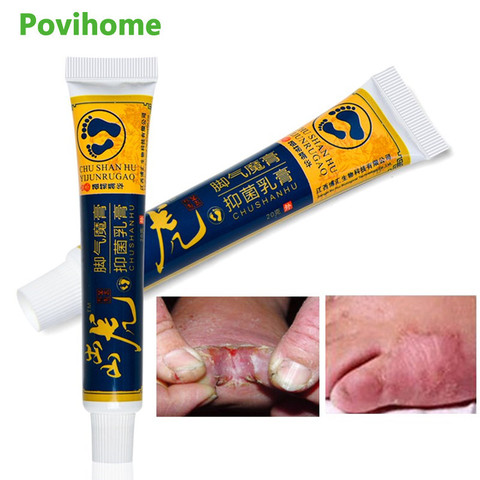 1pcs Foot Corn Cream Athlete's Feet Antibacterial Ointment Anti Itching Blisters Peeling Beriberi Remover Medical Plaster P1120 ► Photo 1/6