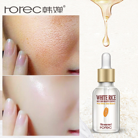 ROREC White Rice Serum Natural & Organic Reduces Wrinkles & Lightens Dark Spots Dark Circle, Fine Line & Sun Damage Corrector ► Photo 1/5