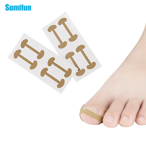 4pcs Ingrown Toenail Correction Tool Straightening Clipper Sticker Toe Nail Pedicure Tool Paronychia Treatment Patch C1701 ► Photo 1/6