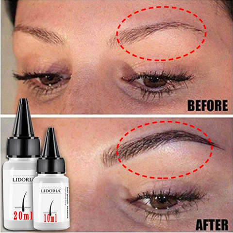 20ml Fast Hair Growth Serum Anti Preventing Hair Lose Liquid Damaged Hair Repair Treatment  Eyelash Eyebrow Growing Thick Care ► Photo 1/6