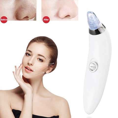 Blackhead Vacuum Acne Cleaner Pore Remover Electric Skin Facial Care Cleansing Comedo Derma Suction Facial Beauty Care Tool ► Photo 1/6