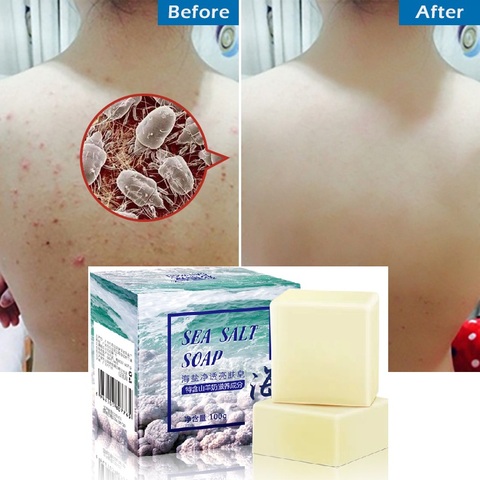 Removal Pimple Pores Acne Treatment Sea Salt Soap Cleaner Goat Milk Moisturizing Face Care Wash Basis for Skin Care Whitening ► Photo 1/6