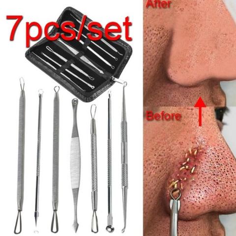 3-8Pcs Blackhead Acne Pimple Remover Needle Stainless Steel Popper Extractor Kit Tools Pore Deep Cleansing Women Beauty Cosmetic ► Photo 1/6