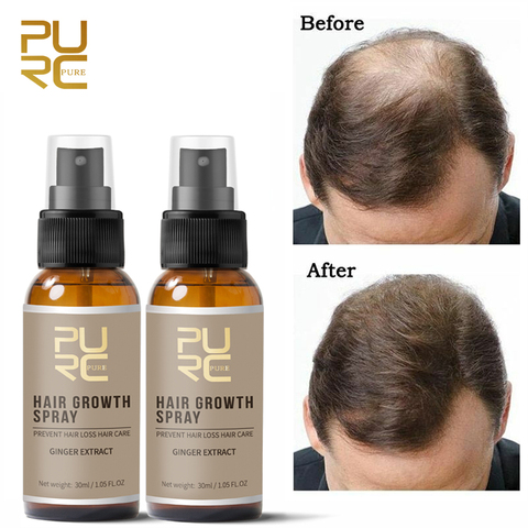 Original Anti Hair Loss Spray Enhance Hair Root Strengthen Fast Hair Growth  Serum Thick & Dense Hair Care 30ml - Price history & Review | AliExpress  Seller - THE PURE SHOP 