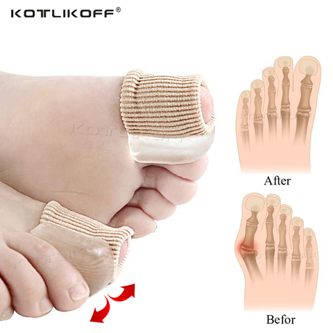 1 pcs Toe Separator Hallux Valgus Bunion Corrector Orthotics Feet Bone Thumb Adjuster Correction Pedicure Sock Straightener Pads ► Photo 1/6