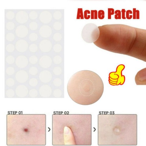 36pcs/set Hydrocolloid Acne Invisible Pimple Master Patch Skin Tag Removal Patch Pimple /Blackhead Blemish Removers Facial Care ► Photo 1/6