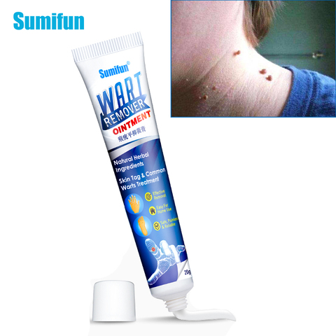 Sumifun 1Pcs Warts Remover Ointment Wart Treatment Cream Skin Tag Remover Herbal Extract Foot Corn Antibacterial Warts Ointment ► Photo 1/6