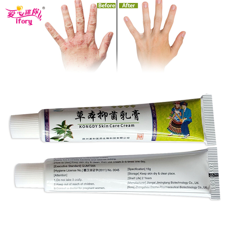 Ifory 5Pcs Natural Powerful Professional Cure Psoriasis Ointment Skin Eczema Cream Dermatitis Eczematoid Eczema Treatment Cream ► Photo 1/5