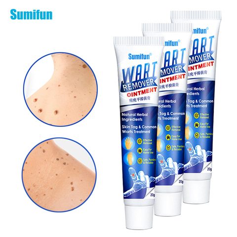 2/3pcs Wart Treatment Cream Warts Remover Antibacterial Ointment Skin Tag Remover Herbal Extract Foot Corn Warts Ointment ► Photo 1/6