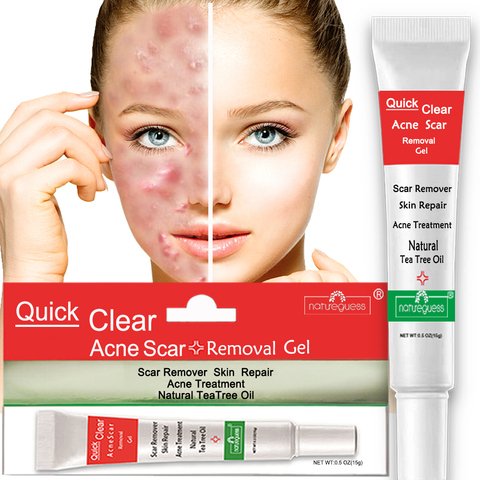 Acne Treatment Face Cream Scar Blackhead Remover Repair Gel Oil Control Shrink Pores Whitening Skin Care Korean Cosmetics ► Photo 1/6